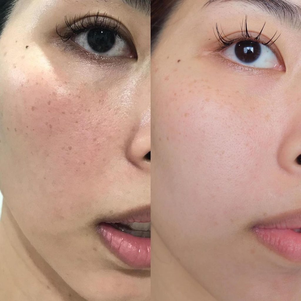 Serum Eucerin Spotless Brightening 30ml