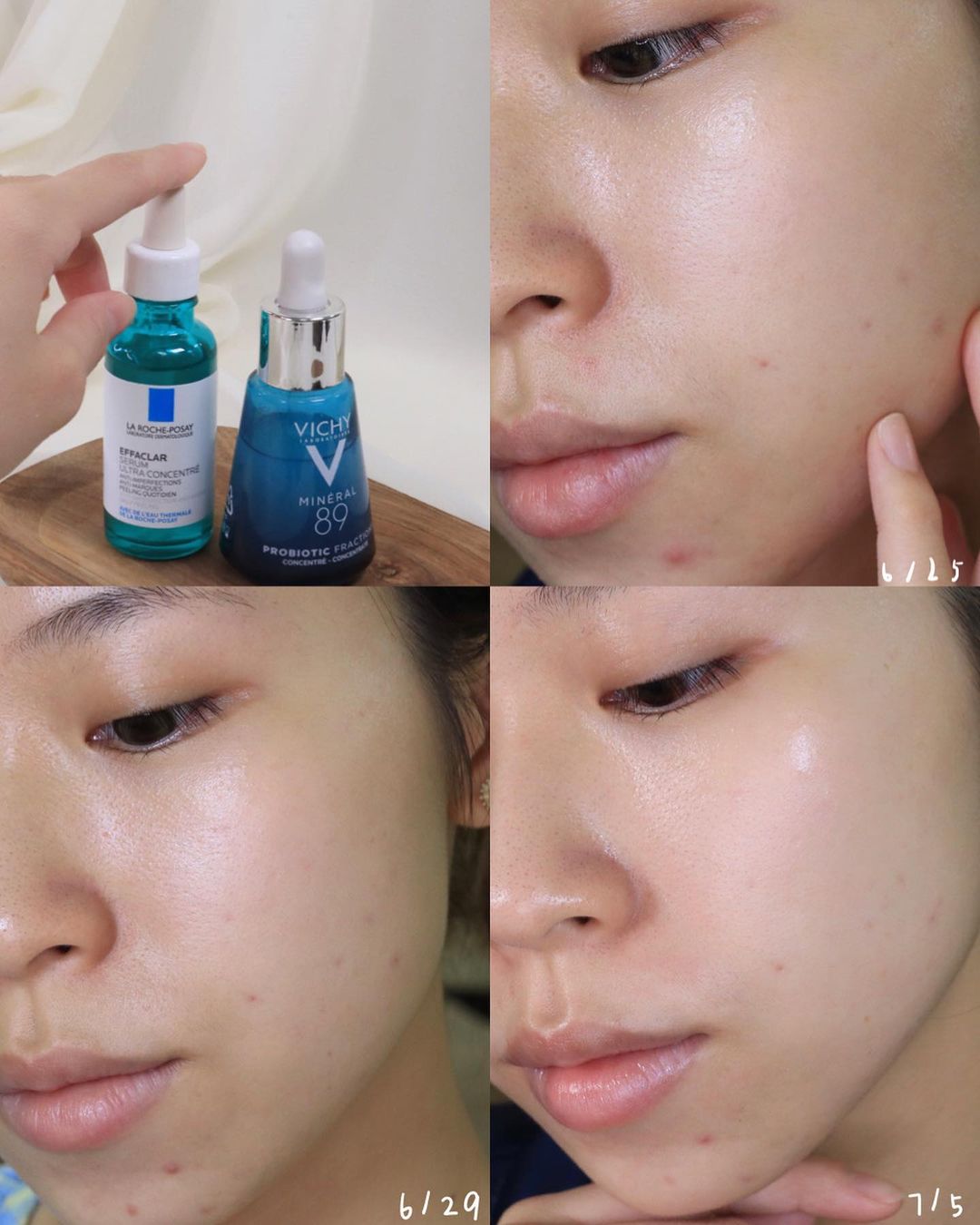 Tinh Chất La Roche-Posay Giảm Mụn 3 Tác Động Effaclar Serum 30ml Tinh Chất La Roche-Posay Giảm Mụn 3 Tác Động Effaclar Serum 30ml - Ảnh 4