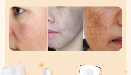 Tổng Hợp Các Serum Trị Nám “quyền lực” Tại Mint