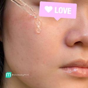 Serum Ngừa Mụn Balance Niacinamide 15% Blemish Recovery 30ml