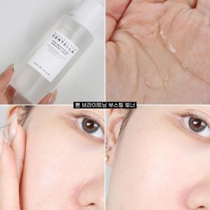 Nước Hoa Hồng Skin1004 Madagascar Centella Tone Brightening Boosting Toner 210ml Nước Hoa Hồng Skin1004 Madagascar Centella Tone Brightening Boosting Toner 210ml
