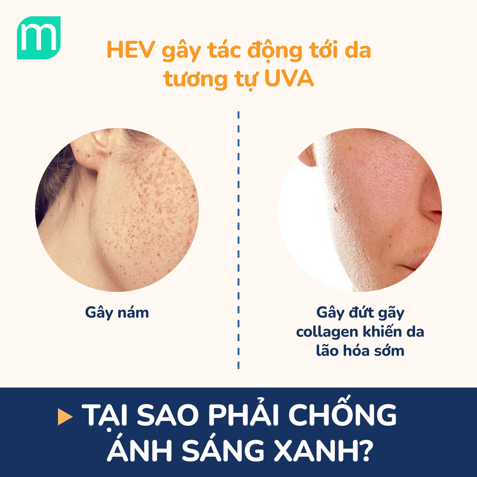 Giải Đáp Thắc Mắc Về Ánh Sáng Xanh