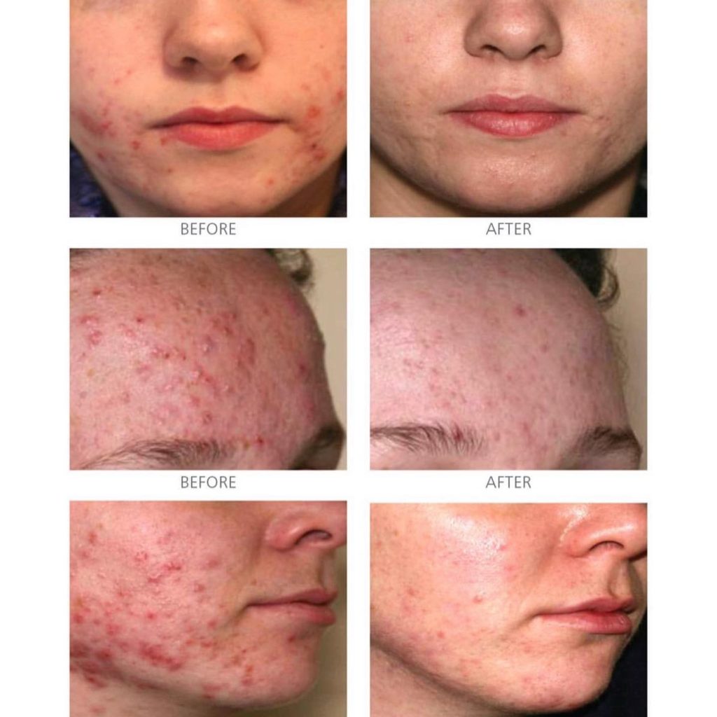 Serum Is Clinical Pro Heal Advance+