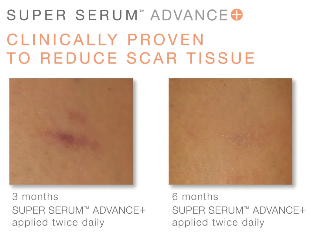 Serum iS Clinical Super Serum Advance+