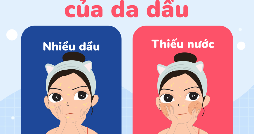 Chuyện Thời Tiết Của Da Dầu: Mùa Da Dầu Và Mùa Da Dầu Thiếu Nước