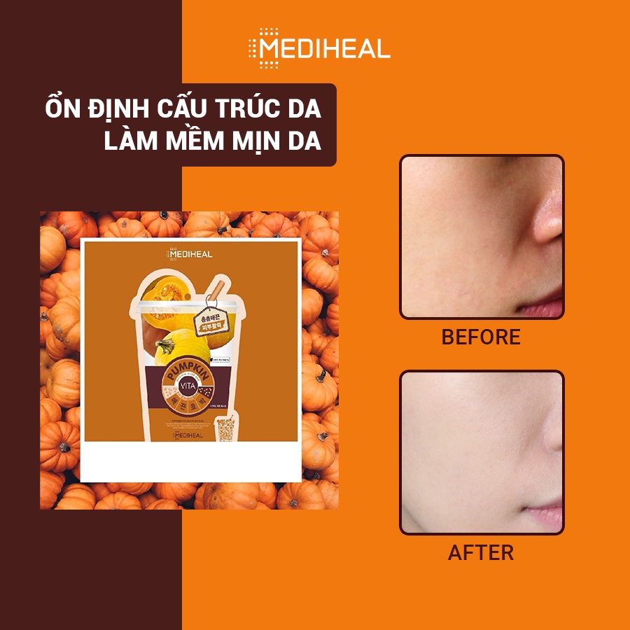 Mặt Nạ Mediheal Pumpkin Vita Mask 20ml Mặt Nạ Mediheal Pumpkin Vita Mask 20ml - Ảnh 5
