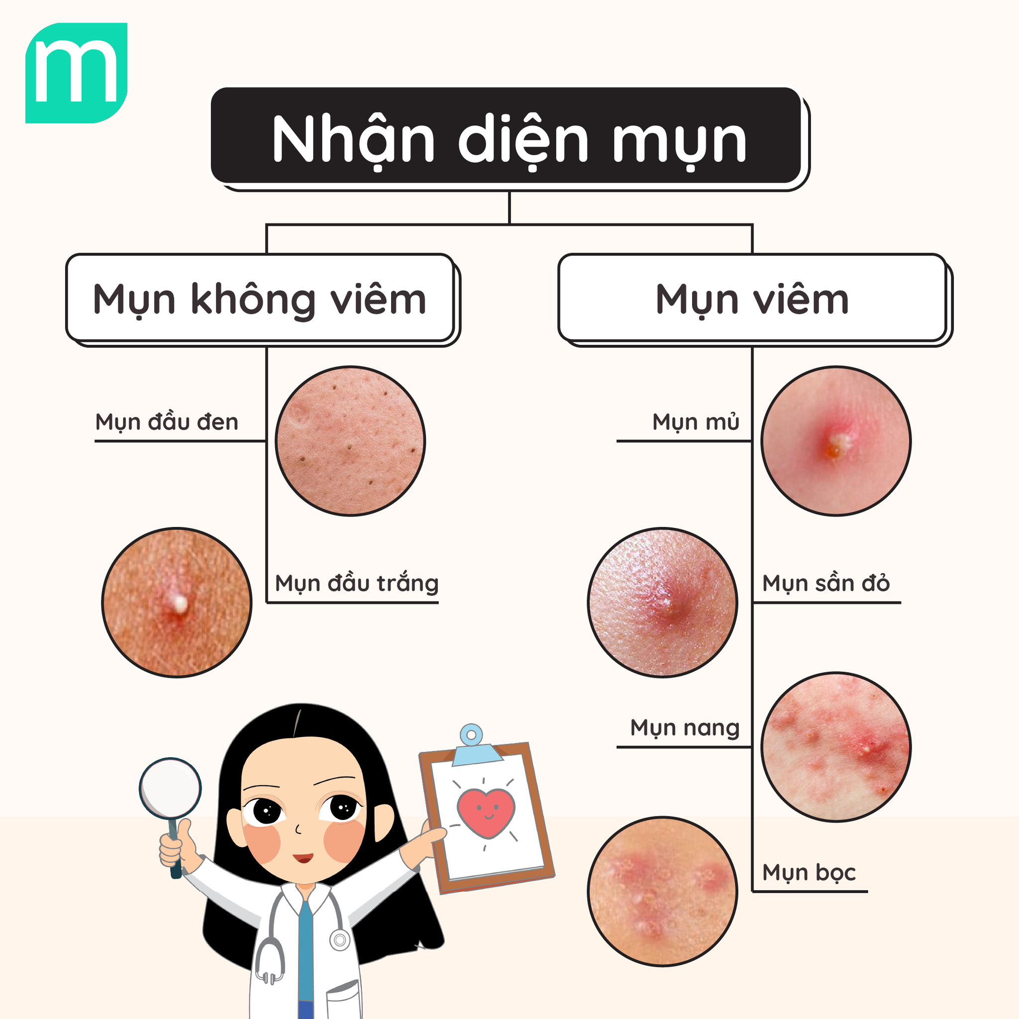 Mụn Nào – Hoạt Chất Nấy