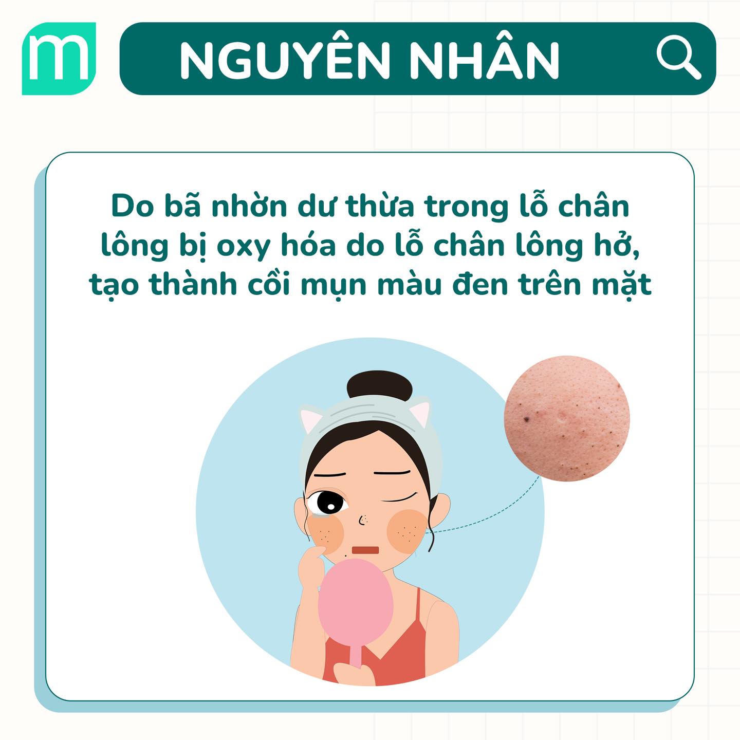Tìm Hiểu Về Mụn Đầu Đen 
