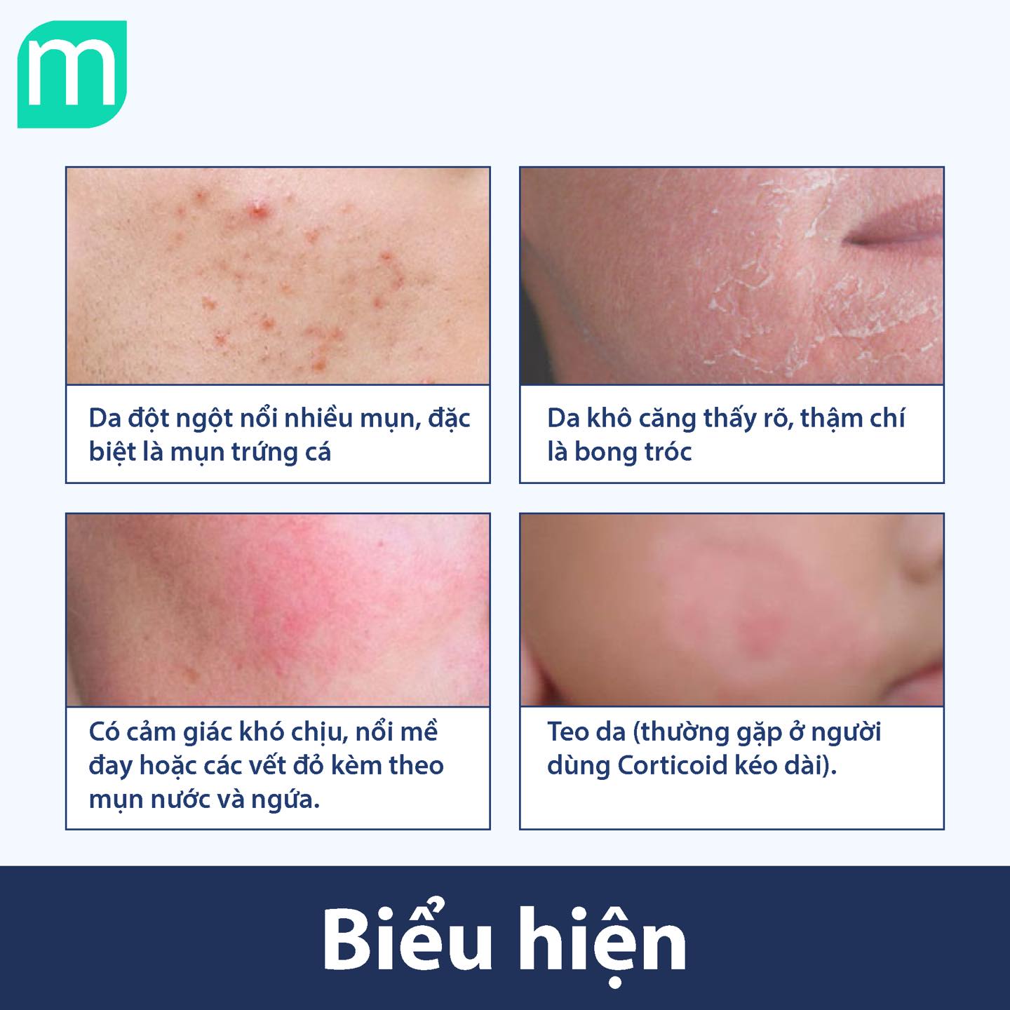 Đối Phó Với Da Kích Ứng