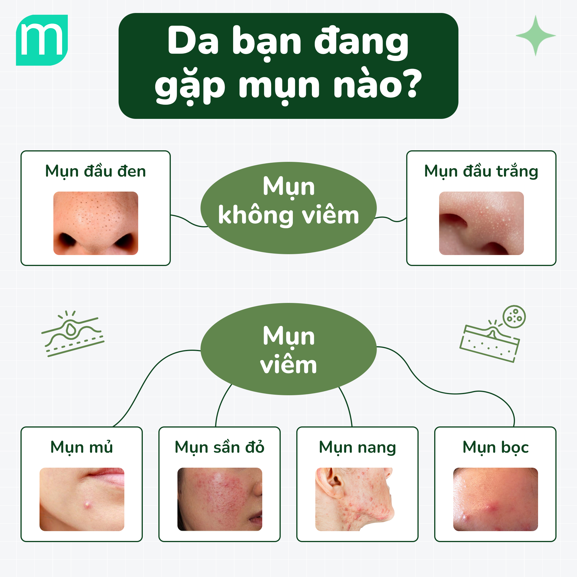 MỤN – Hiểu Sâu, Trị Kỹ