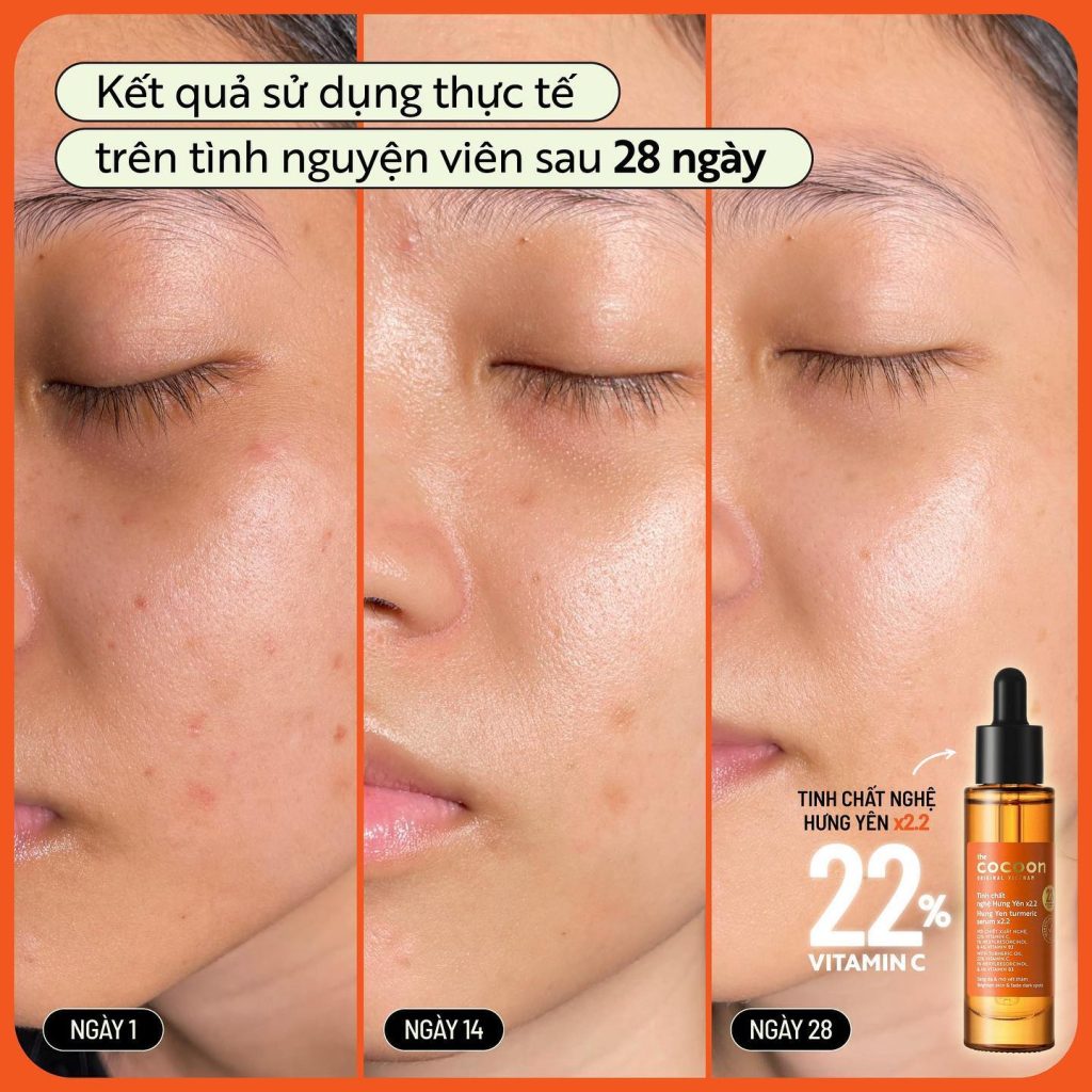 Serum Cocoon Nghệ Hưng Yên C22 30ml