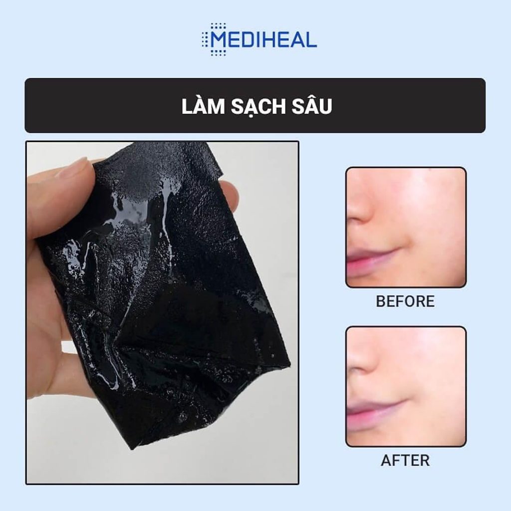 Mặt Nạ Giấy Mediheal Solution Mask