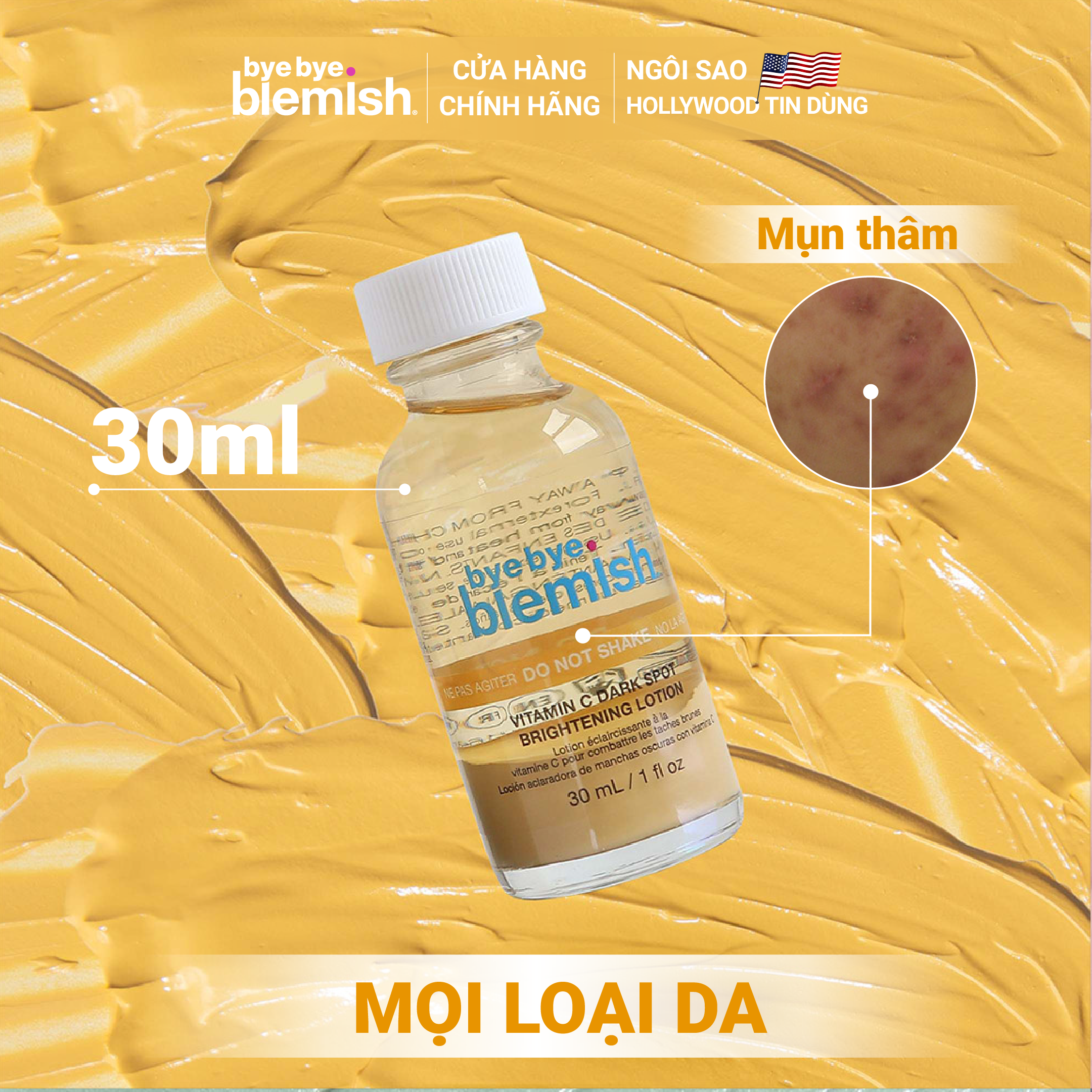 Chấm Mụn Bye Bye Blemish Vitamin C Dark Spot Brightening Lotion 30ml