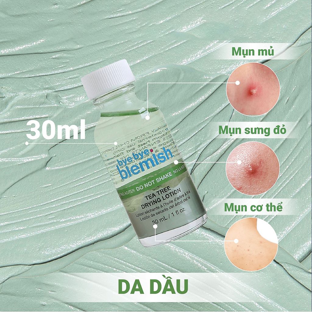 Lotion Chấm Mụn Bye Bye Blemish Dành Cho Mụn Sưng Viêm 30ml