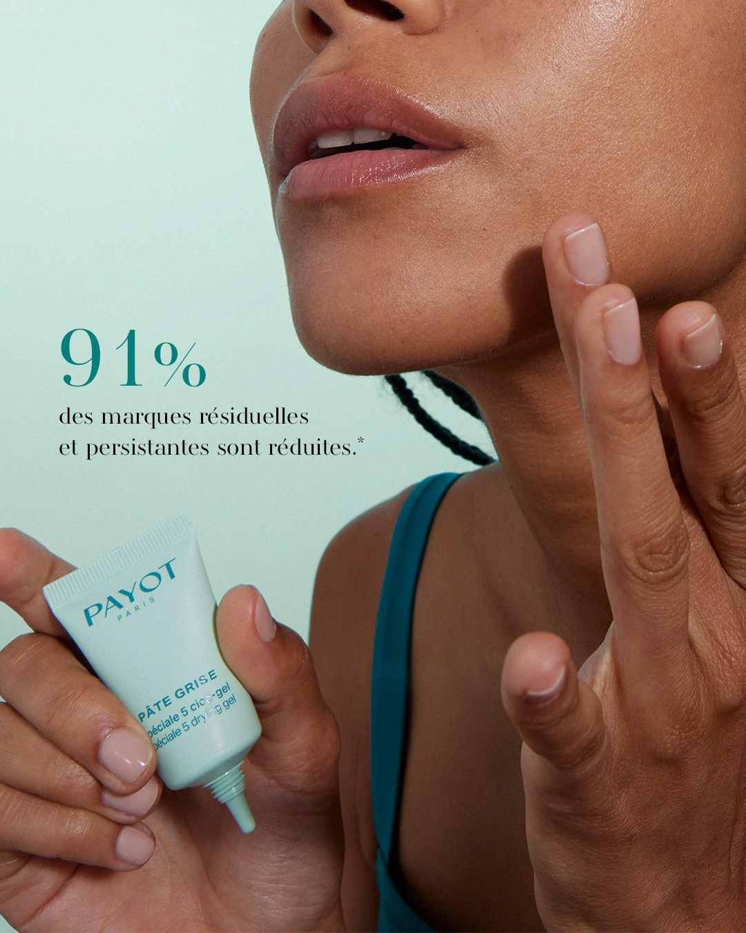 Gel Chấm Mụn Payot Pate Grise Speciale 5 Drying Gel 15ml Gel Chấm Mụn Payot Pate Grise Speciale 5 Drying Gel 15ml