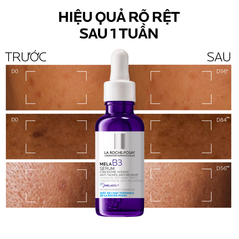 Serum Giúp Mờ Thâm Nám Và Sáng Da Laroche Posay Mela B3 40ml Serum Giúp Mờ Thâm Nám Và Sáng Da Laroche Posay Mela B3 40ml