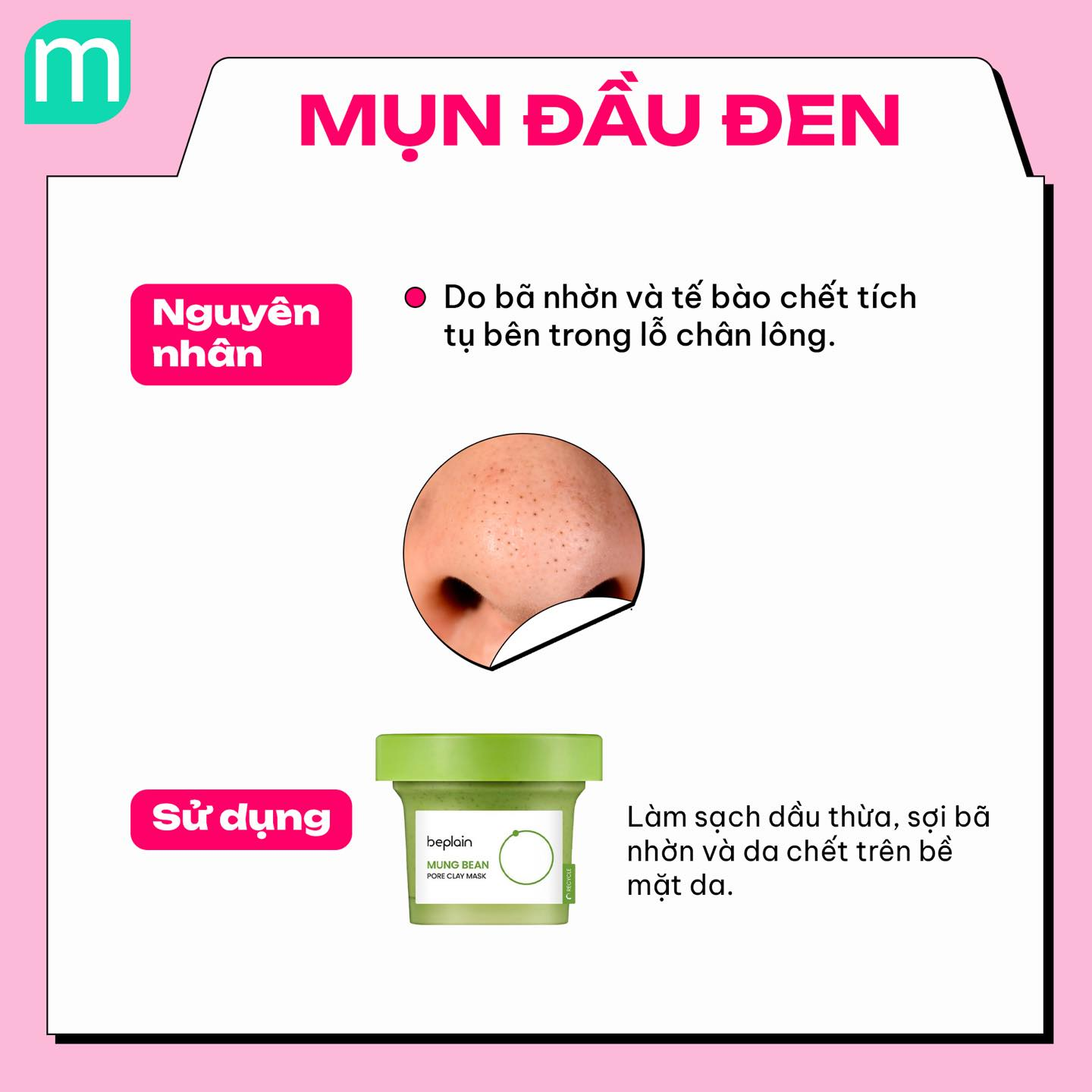 4 dạng mụn phổ biến và cách xử lý cơ bản
