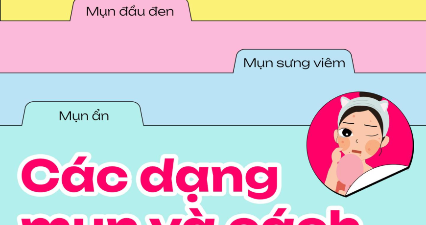 4 dạng mụn phổ biến và cách xử lý cơ bản