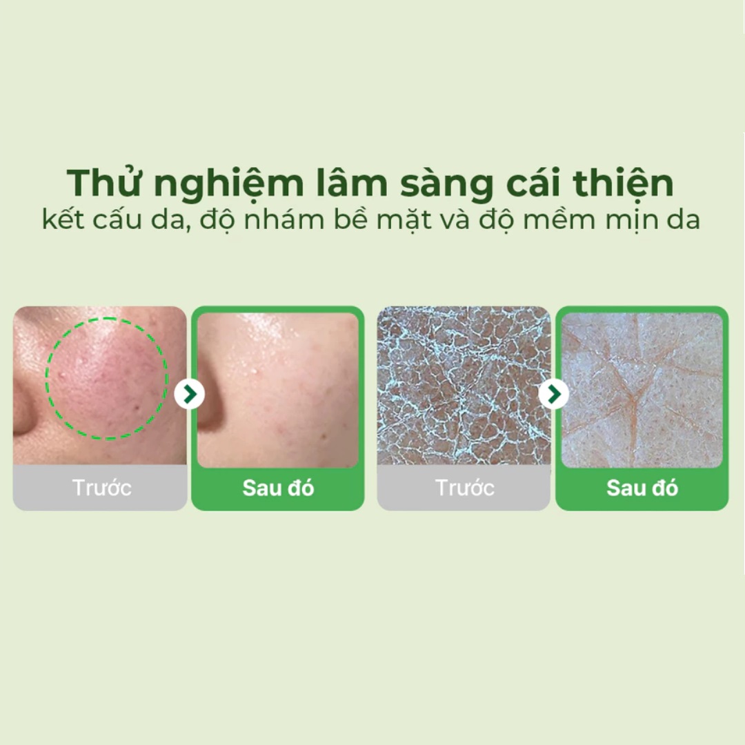 Toner Pad Làm Mát Dịu Da Torriden Balanceful Cica 60 Miếng Toner Pad Làm Mát Dịu Da Torriden Balanceful Cica 60 Miếng