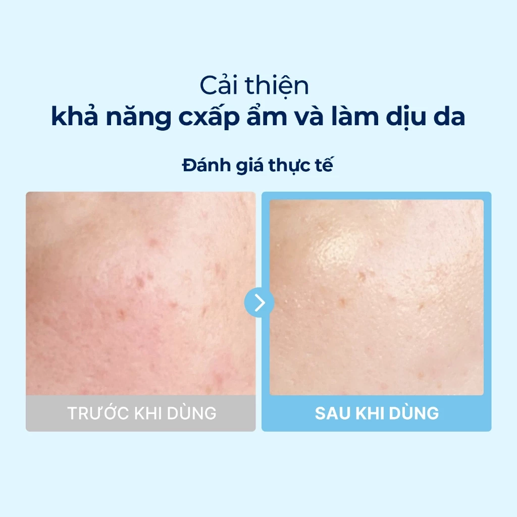 Toner Pad Torriden Dive In Low Molecular Hyaluronic Acid Multi Pad 80 Miếng Toner Pad Torriden Dive In Low Molecular Hyaluronic Acid Multi Pad 80 Miếng