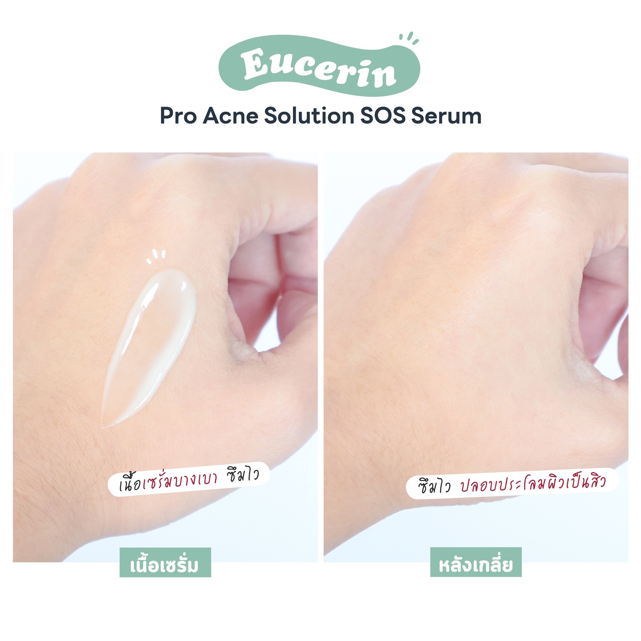 Tinh Chất Dưỡng Da Cho Da Mụn Eucerin Pro Acne SOS Serum 40ml Tinh Chất Dưỡng Da Cho Da Mụn Eucerin Pro Acne SOS Serum 40ml