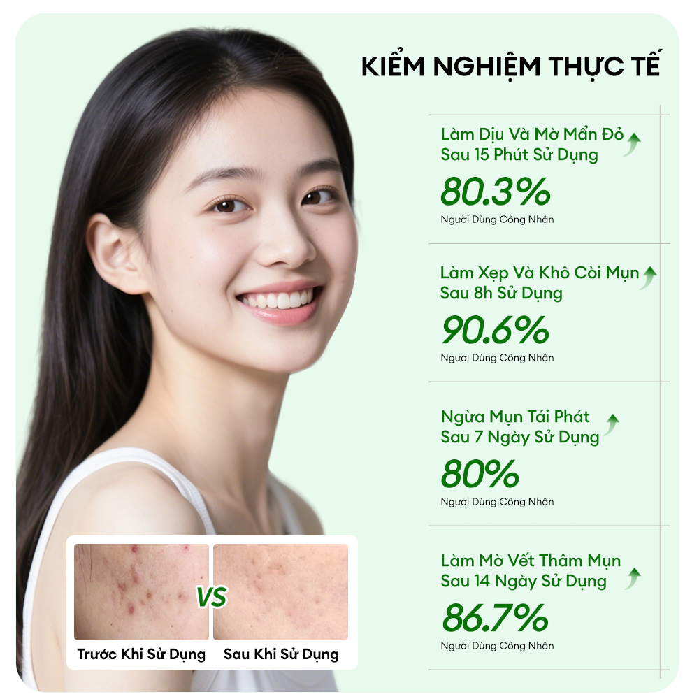 Kem Trị Mụn Colorkey Luminous Green Tea Purifying Acne Treatment 20g Kem Trị Mụn Colorkey Luminous Green Tea Purifying Acne Treatment 20g