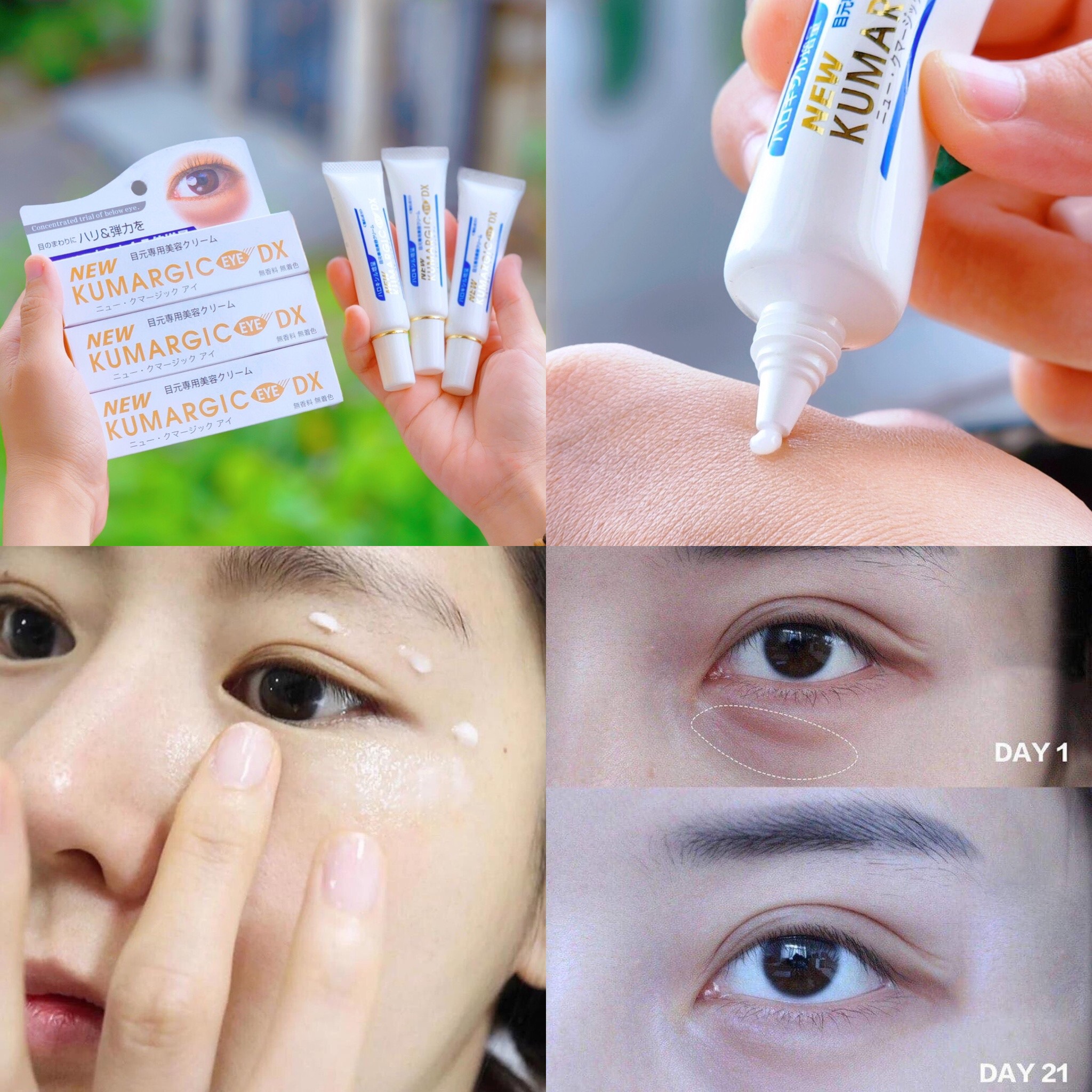 Kem Mắt Kumargic 20g Kem Mắt Kumargic 20g