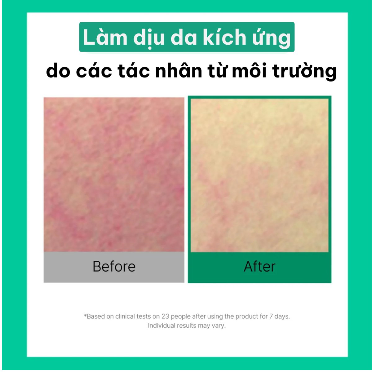 Toner Pad Cell Fusion C Rau Má Cica Cooling Pad 70 Miếng Toner Pad Cell Fusion C Rau Má Cica Cooling Pad 70 Miếng