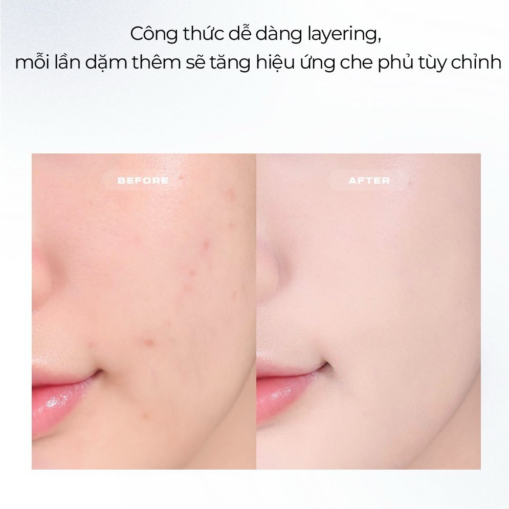 Kem Nền About Tone Skin Layer Fit Foundation 30ml Kem Nền About Tone Skin Layer Fit Foundation 30ml