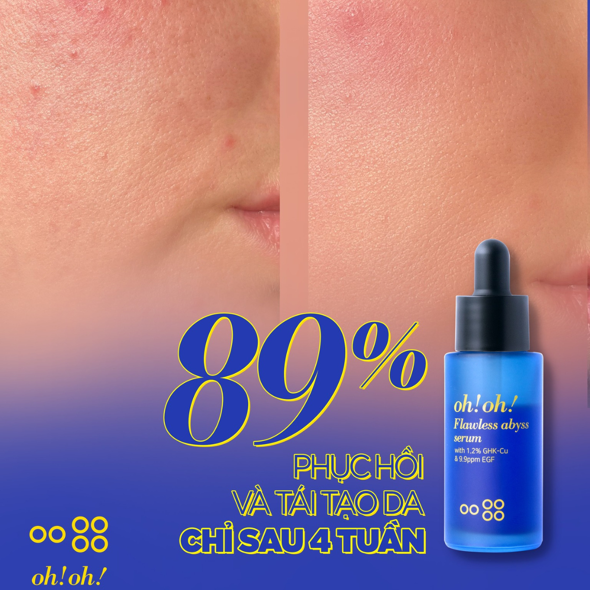 Tinh Chất Phục Hồi Chuyên Sâu Oh! Oh! Flawless Abyss Serum 15g Tinh Chất Phục Hồi Chuyên Sâu Oh! Oh! Flawless Abyss Serum 15g - Ảnh 6