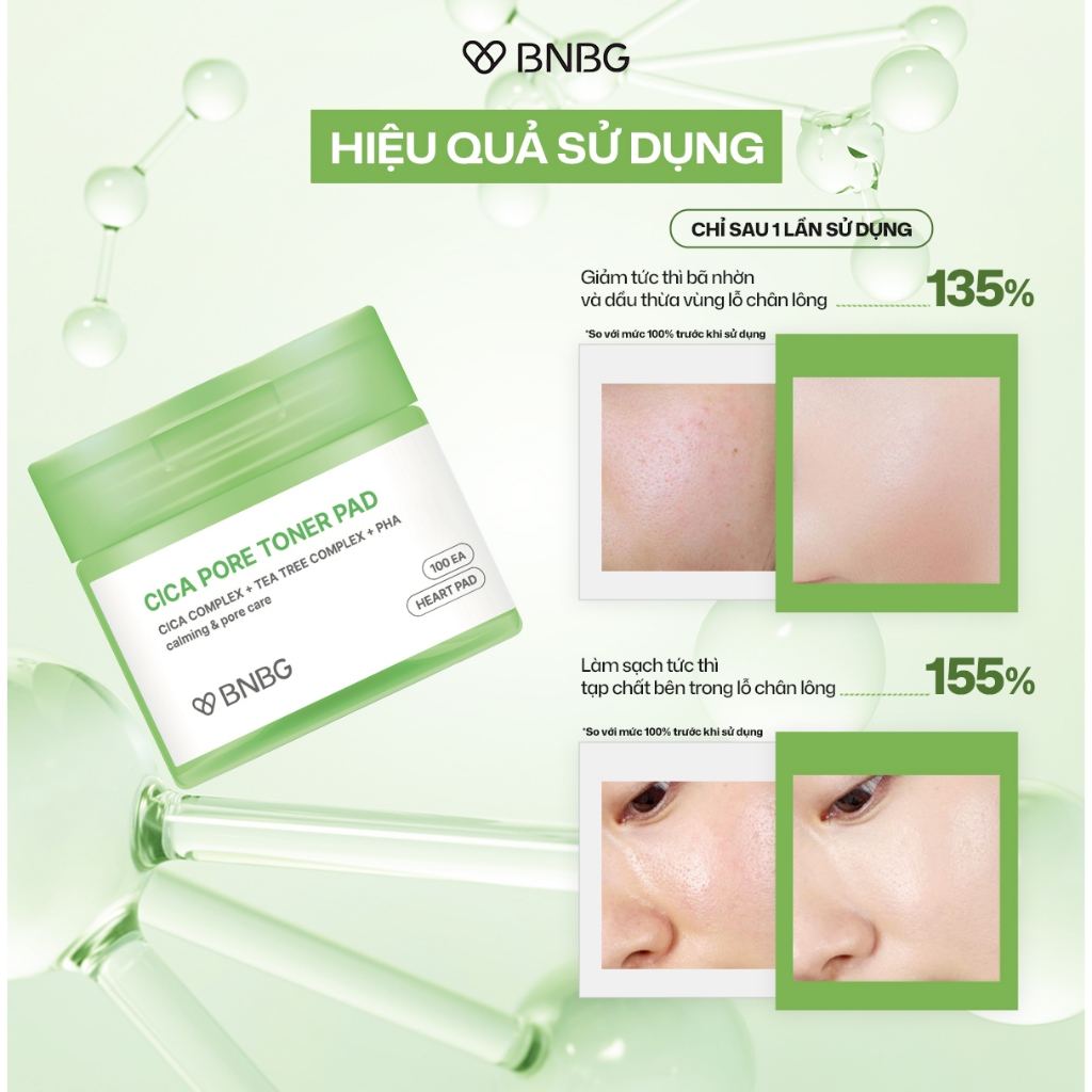 Toner Pad Dạng Bông BNBG Cica Pore Hỗ Trợ Lỗ Chân Lông 100 Miếng Toner Pad Dạng Bông BNBG Cica Pore Hỗ Trợ Lỗ Chân Lông 100 Miếng